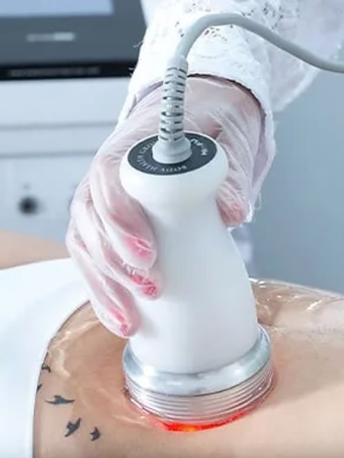 CAVITATION